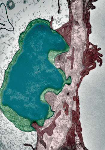 Imagen A: Microscopía electrónica de una célula tumoral (azul, verde) en el camino a su extravasación a través de un capilar sanguíneo del endotelio alveolar (morado, rojo). Se ven protuberancias de las células tumorales formando su camino a través de la célula endotelial (Fotografía cortesía de la Universidad de Zúrich).